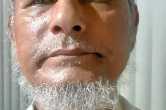 মানবেতর জীবন যাপন করছেন মানবাধিকার কর্মি