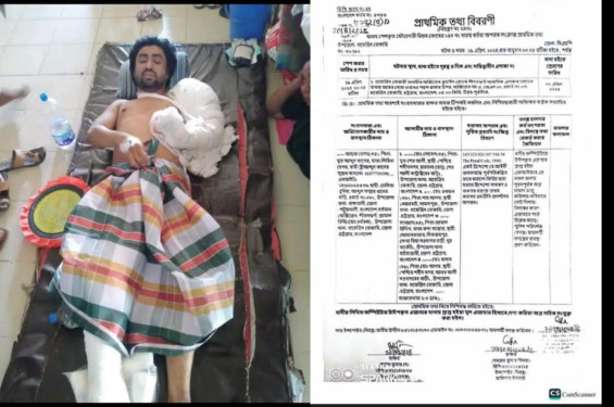 বায়েজিদে সন্ত্রাসী  হামলায় ব্যবসায়ী আহতের ঘটনায় আতংক