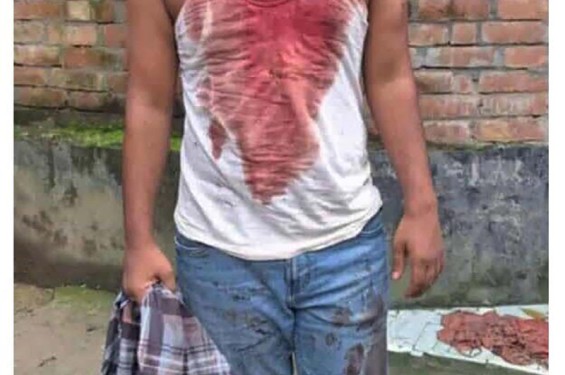 বেনাপোলে পাওনা টাকার জেরে ব্যবসায়ীকে মারধর, ৩টি গরু ও এক লাখ টাকা ছিনতাই