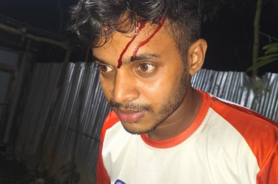 বাঁশখালীতে এনসিপির সংগঠক তানভীরের ওপর হামলার অভিযোগ
