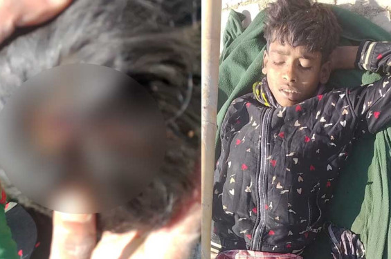 মিয়ানমার থেকে ছোড়া গুলিতে টেকনাফে দুই কিশোর আহত