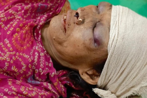 জমা- জমির বিরোধকে কেন্দ্র করে ষাটোর্ধ্ব নারীর মৃত্যু