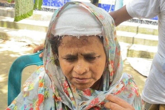 মাধবদীতে টাকার জন্য বৃদ্ধা মায়ের মাথা ফাটালো মাদকাসক্ত ছেলে