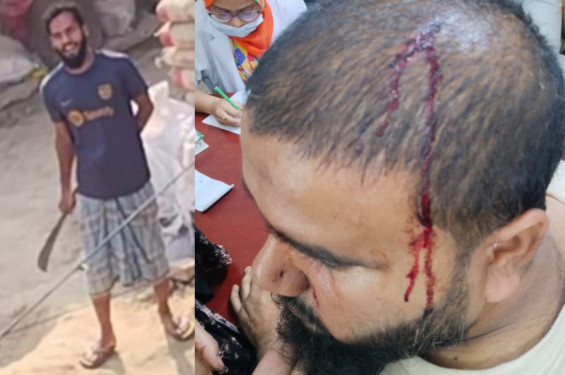 বোয়ালখালীতে জমি বিরোধে সংঘর্ষ, আহত ৩