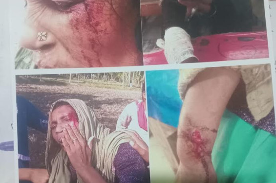 পঞ্চগড়ে কৃষক পরিবারের জমি দখলের চেষ্টা, হামলার অভিযোগ