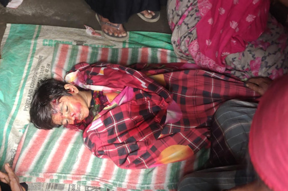 বাউফলে ট্রলির চাকায় পিষ্ট হয়ে চার বছরের শিশুর মৃত্যু