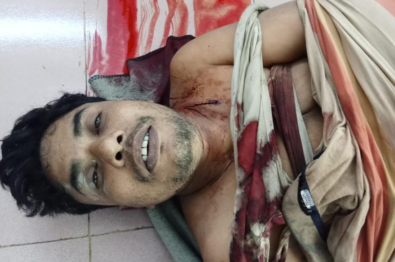 হাতিয়ায় চরের জমি দখল নিয়ে দুই পক্ষের গোলাগুলি, নিহত ৫