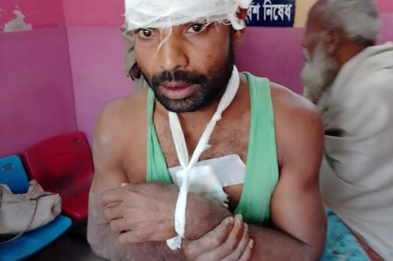 নোয়াখালীতে কৃষকের হাত ভেঙে কুপিয়ে জখম