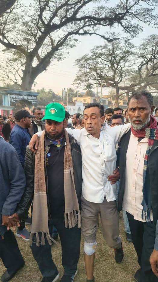 কালীগঞ্জে স্বতন্ত্র প্রার্থীর সভায় যাওয়ার পথে হামলা, আহত ৩