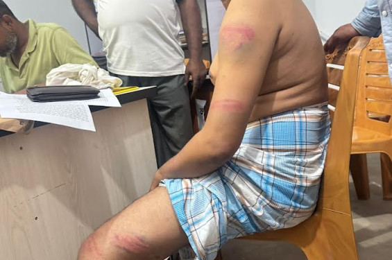নোয়াখালীতে মাটি কাটা নিয়ে বিরোধের জেরে  বিএনপি নেতার ওপর হামলা, থানায় মামলা