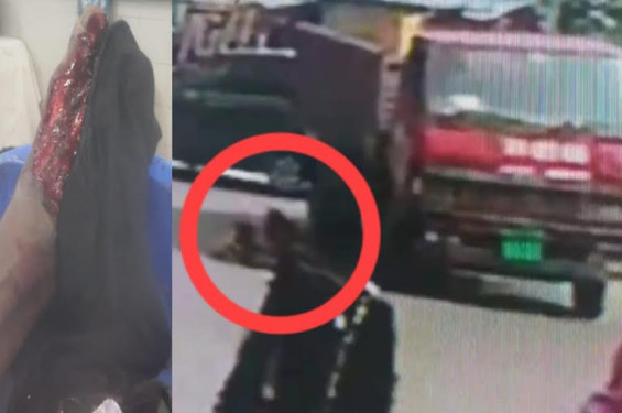 শেরশাহে বিআরটিসি ট্রাকের ধাক্কায় এক যুবক গুরুতর আহত