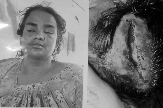 ভাসুরের শাবলের আঘাতে ছোট ভাইয়ের স্ত্রীর মৃত্যু