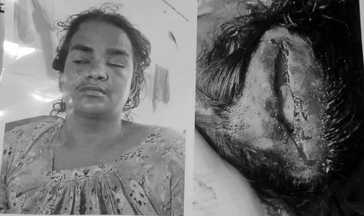ভাসুরের শাবলের আঘাতে ছোট ভাইয়ের স্ত্রীর মৃত্যু