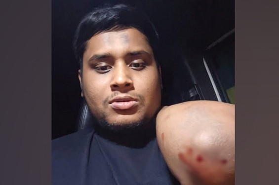 গাজীপুরে হাসনাত আবদুল্লাহর গাড়িতে হামলা