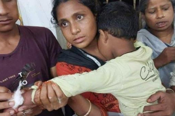 শ্রীমঙ্গলে ১ জুন থেকে ১০ জুন পর্যন্ত, ১০ দিনে কুকুরের কামড়ে আহত ৪৫