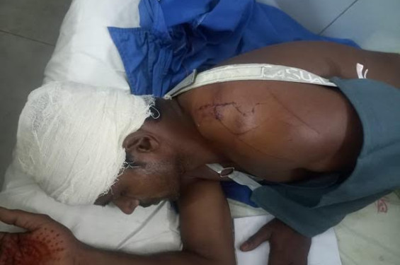 জগন্নাথপুরে  নৌকা রাখা নিয়ে দ্বন্দ্ব, দুই পক্ষের সংঘর্ষে আহত ১০