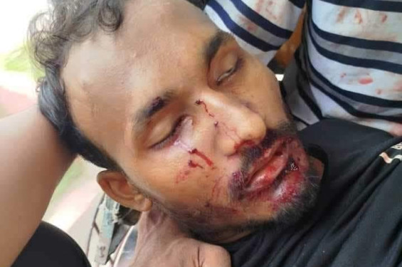 রংপুরে কোটা আন্দোলনকারীদের অন্যতম সমন্বয়ক আবু সাঈদ নিহত