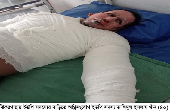 ঝিকরগাছায় ইউপি সদস্যের বাড়িতে অগ্নিসংযোগ : শিশুসহ একই পরিবারের দগ্ধ-৪