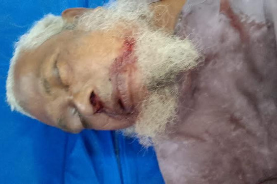 যশোরে মাইক্রোর ধাক্কায় ভ্যান চালক নিহত