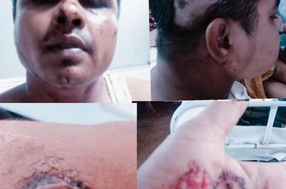 চট্টগ্রাম শহরে বাঁশখালীর পুলিশ সদস্যের উপর হামলা