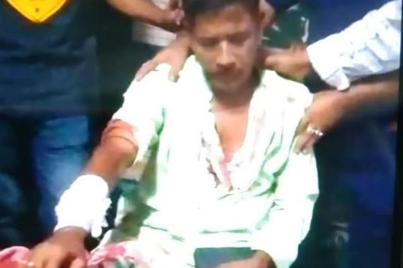 বেনাপোলে প্রতিপক্ষের হামলায় একজন আহত