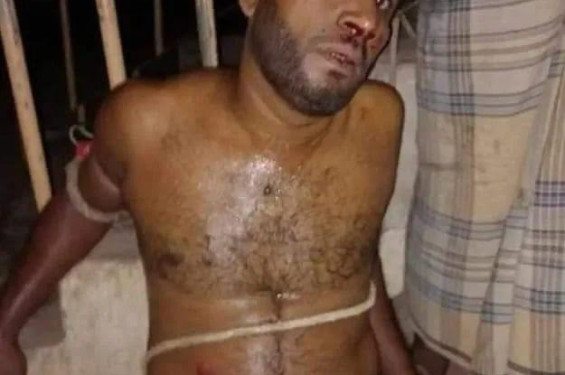 বাঁশখালীতে যুবলীগ নেতা ইউপি সদস্যকে গণপিটুনি, গ্রেফতার
