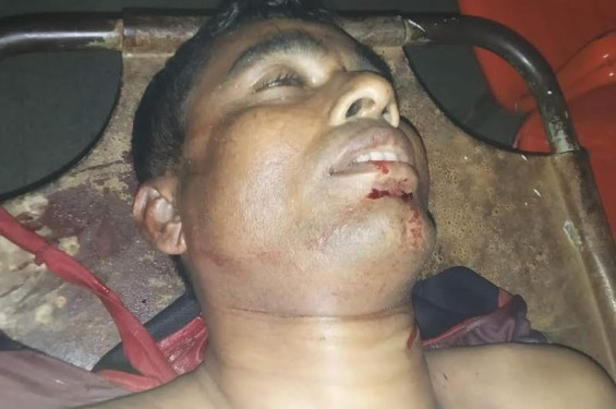 বাঁশখালীর কয়লা বিদ্যুৎ প্রকল্পে হামলা, সাবেক সেনা কর্মকর্তাসহ নিহত ২