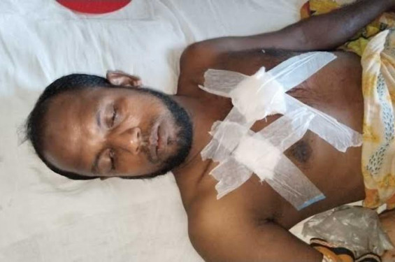 শরণখোলায় শুকরের আক্রমনে তিন আপন ভাই