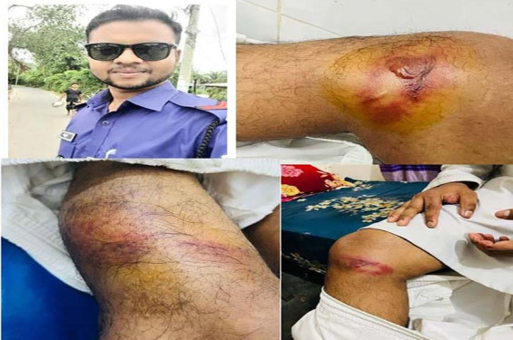 শার্শায় পুলিশ সদস্যকে হত্যাচেষ্টার অভিযোগে বিএনপি নেতাসহ ছয়জনের বিরুদ্ধে মামলা