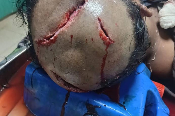 নোয়াখালীতে জমি নিয়ে বিরোধের জেরে কুপিয়ে জখম বৃদ্ধের ১০ দিন পর হাসপাতালে মৃত্যু
