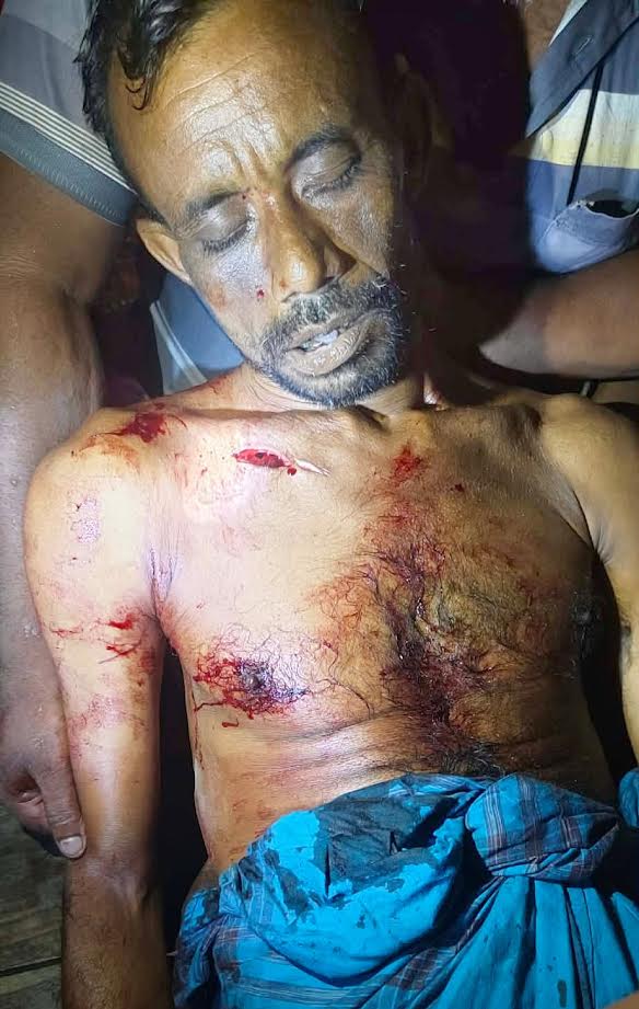 নড়াইলে মাদক সেবনে বাধা দেওয়ায় কৃষককে কুপিয়ে হত্যার অভিযোগ, ইউপি সদস্য লাঞ্ছিত