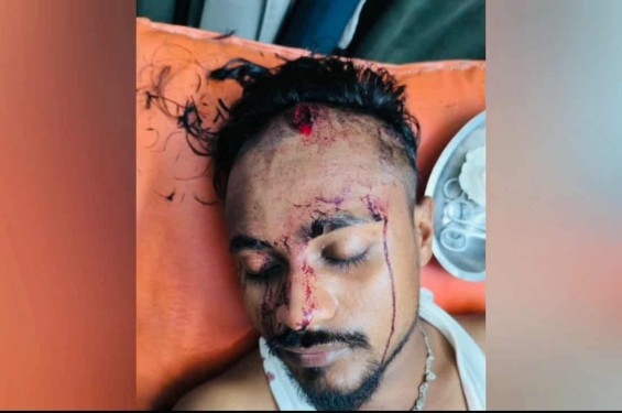 রূপগঞ্জে মুড়াপাড়ায়  মাদক সেবন করে মাতলামি,  প্রতিবাদ করায়  দুইজন গুলিবিদ্ধ