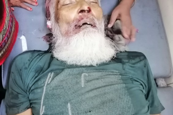 বামনায় সড়ক দুর্ঘটনায় নিহত ১