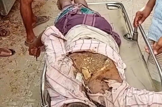 লোহাগাড়ায  ঝুঁকিপূর্ণ ৩৩ হাজার ভোল্টের  লাইনের  সংস্পর্শে দিনমজুরের মৃত্যু