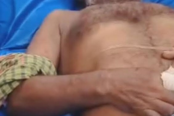 বিষধর সাপের পানি খাওয়াতে গিয়ে কামড়ে সাপুড়িয়া'র মৃত্যু