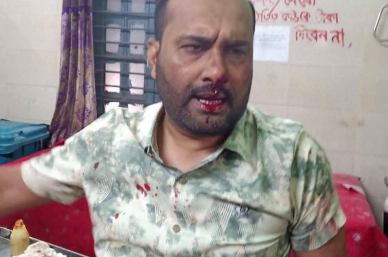 কালীগঞ্জ উপজেলা স্বাস্থ্য কমপ্লেক্সের মেডিকেল টেকনোলজিস্টকে পিটিয়ে রক্তাক্ত করলেন সহকর্মী