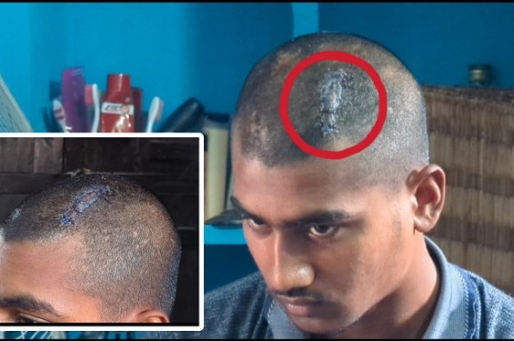 ঝিনাইদহে জমি সংক্রান্ত বিরোধে দুই পক্ষের সংঘর্ষ, কিশোর রিফাত আহত