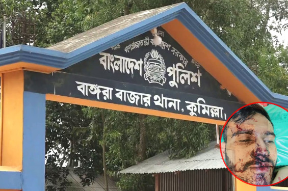 সন্ত্রাসী হামলায় আহত ৩, গ্রেফতার হয়নি কেউ
