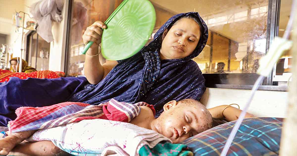 হাম উপসর্গে ৫ জনের   মৃত্যু, আক্রান্ত ১৩৪২