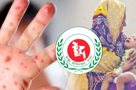 হাম ও হামের উপসর্গে আরও তিন জনের মৃত্যু