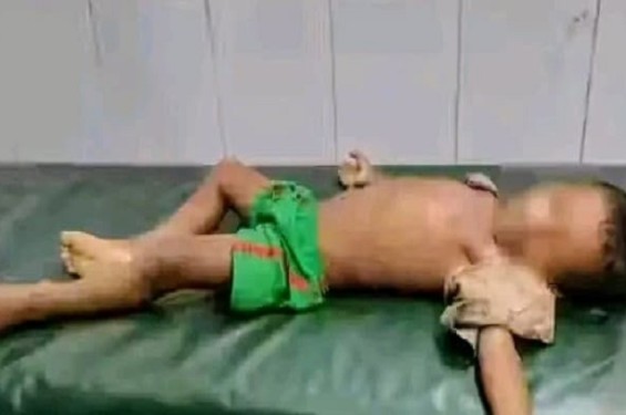 শেরপুরে লিচুর বিচি গলায় আটকে ৪ বছরের শিশুর মর্মান্তিক মৃত্যু