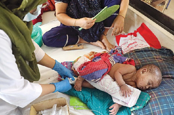 ২৪ ঘণ্টায় হাম উপসর্গে ৪ শিশুর মৃত্যু