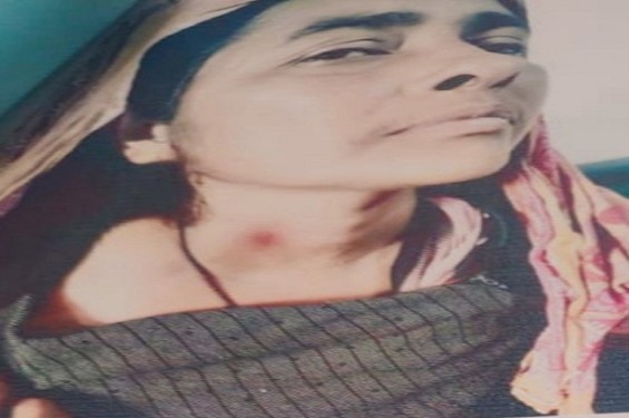 বাঁশখালীতে বিধবার উপর হামলা, ঘরবাড়ি ভাংচুর