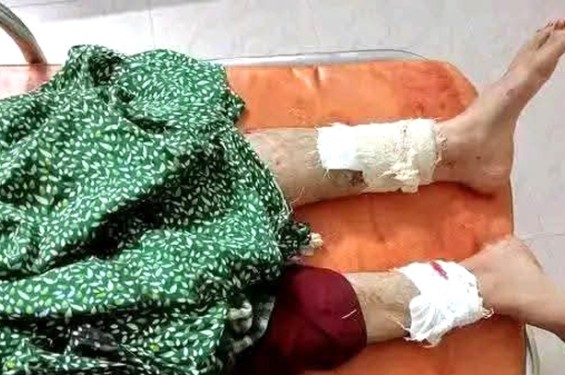 লক্ষ্মীপুরে ঘুমন্ত স্ত্রীর পায়ের রগ কেটে দিলেন স্বামী