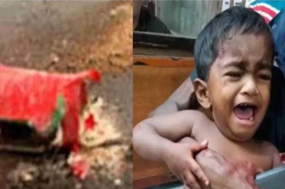 যশোরে বিস্ফোরণে আহত শিশু খাদিজার মৃত্যু, ককটেল ঘিরে রহস্য