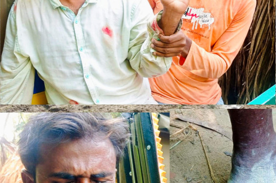 বাঁশখালীতে বরই বাগানে প্রতিপক্ষের হামলায় মালিকসহ আহত ২