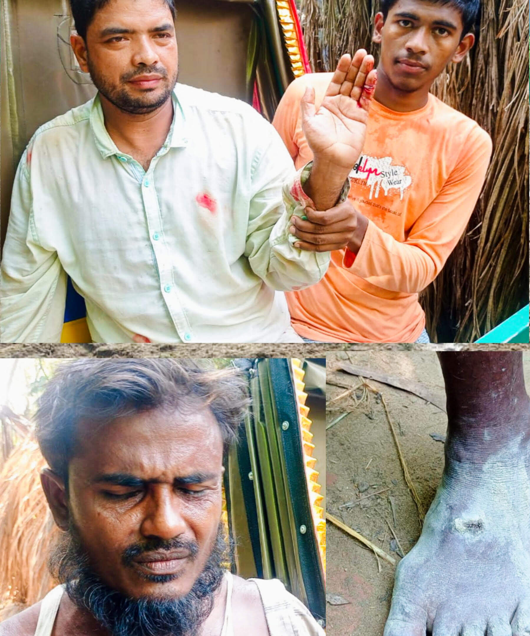 বাঁশখালীতে বরই বাগানে প্রতিপক্ষের হামলায় মালিকসহ আহত ২