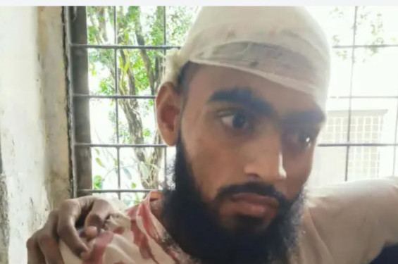 মাদকের বিরোদ্ধে প্রতিবাদ করায় মসজিদের ইমাম কে কুপিয়ে জখম