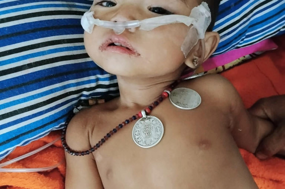 আলীকদমে হামের উপসর্গে আরও এক শিশুর মৃত্যু, মৃতের সংখ্যা বেড়ে ৬