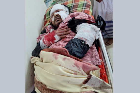 কুয়াকাটায় সাংবাদিককে কুপিয়ে বাসার সামনে ফেলে রেখে গেছে দুর্বৃত্তরা